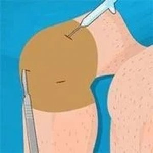 Operate Now: Knee Surgery Online Game